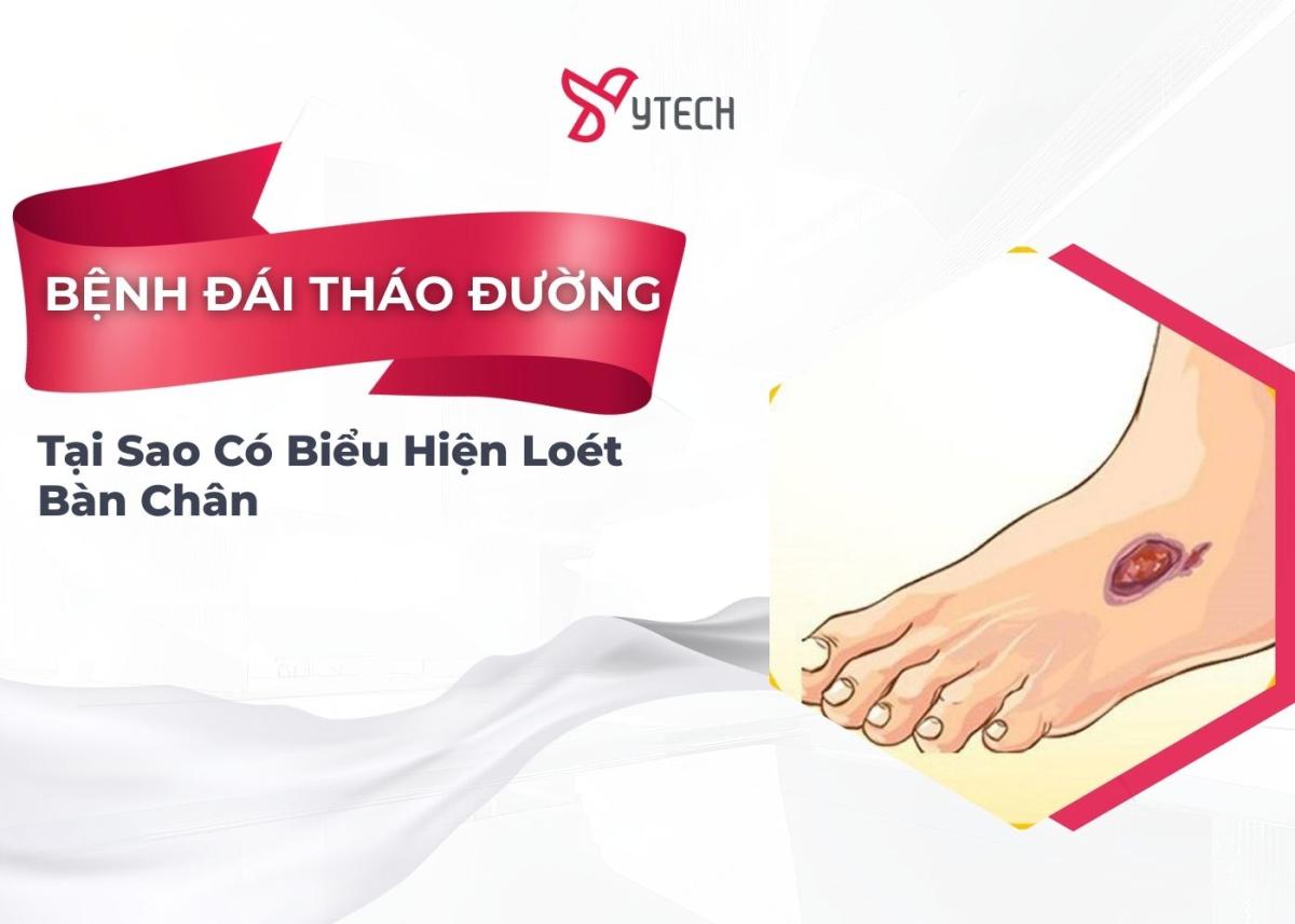 TẠI SAO LOÉT BÀN CHÂN LÀ BIỂU HIỆN CỦA NGƯỜI BỊ ĐÁI THÁO ĐƯỜNG?