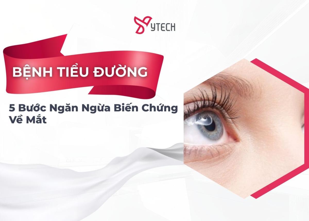 5 BƯỚC NGĂN NGỪA BỆNH VỀ MẮT DO TIỂU ĐƯỜNG