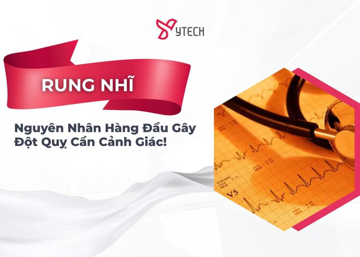 RUNG NHĨ - NGUYÊN NHÂN HÀNG ĐẦU GÂY ĐỘT QUỴ CẦN CẢNH GIÁC!