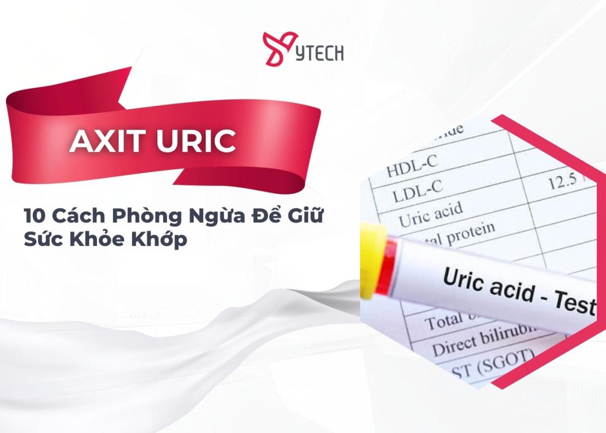 GIỮ SỨC KHỎE KHỚP CỦA BẠN BẰNG 10 CÁCH PHÒNG NGỪA AXIT URIC