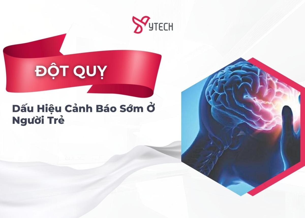 ĐỘT QUỴ Ở NGƯỜI TRẺ - DẤU HIỆU CẢNH BÁO SỚM!