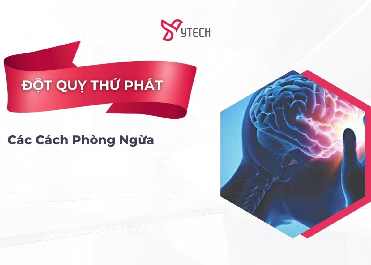 PHÒNG NGỪA ĐỘT QUỴ THỨ PHÁT