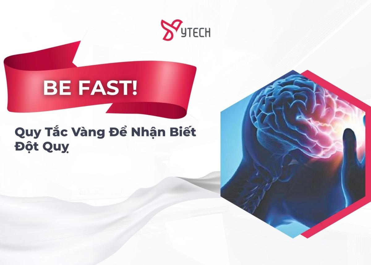 BE FAST! Quy tắc vàng để nhận biết ĐỘT QUỴ