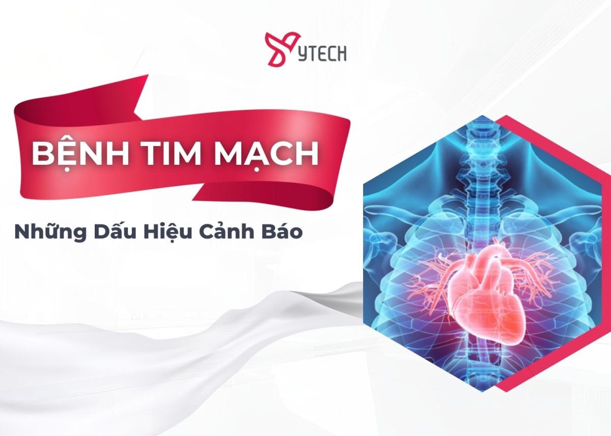 NHỮNG DẤU HIỆU CẢNH BÁO BỆNH TIM MẠCH