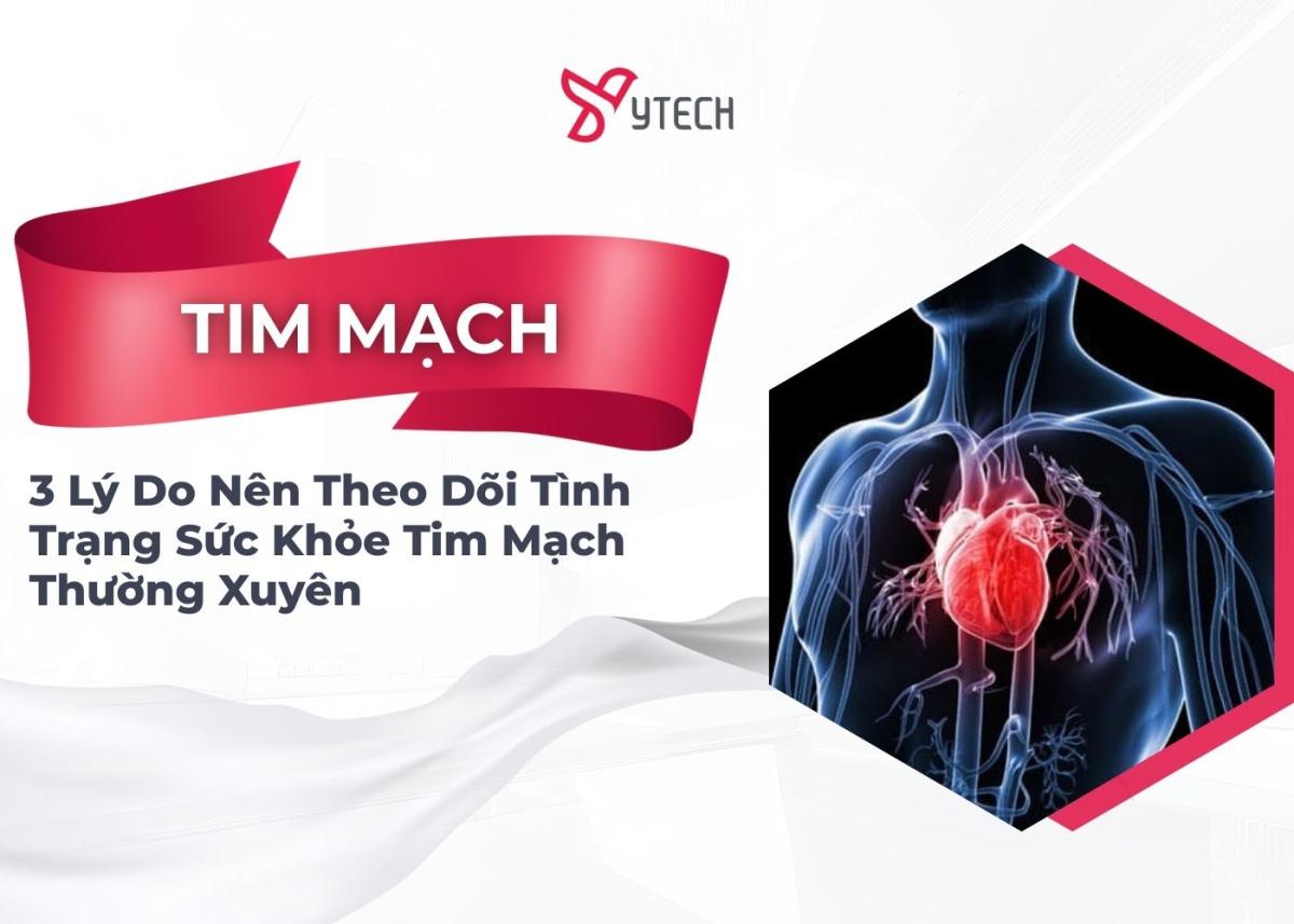 3 LÝ DO NÊN THEO DÕI TÌNH TRẠNG SỨC KHỎE TIM MẠCH