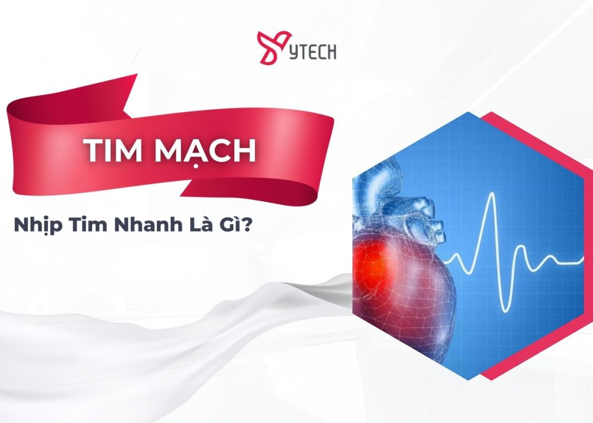 Nhịp tim nhanh là gì?