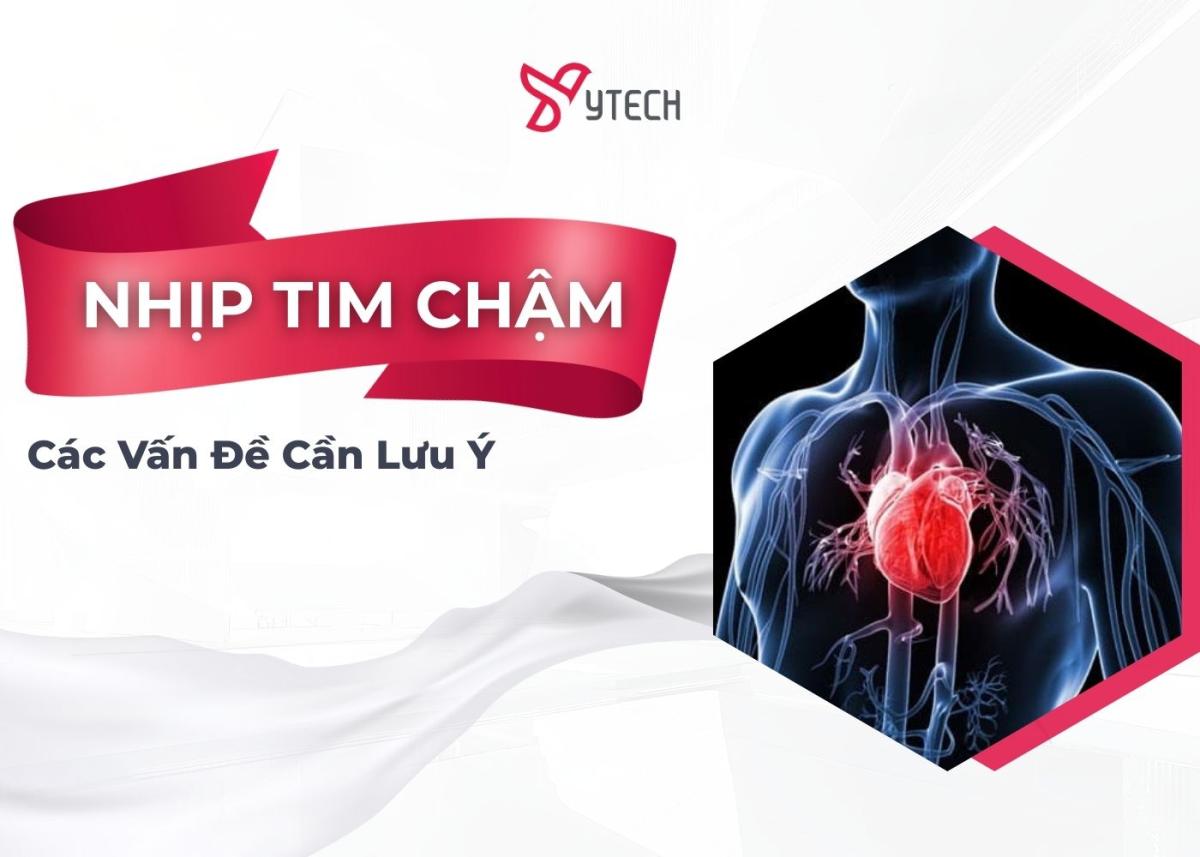 Các vấn đề cần biết về Nhịp tim chậm