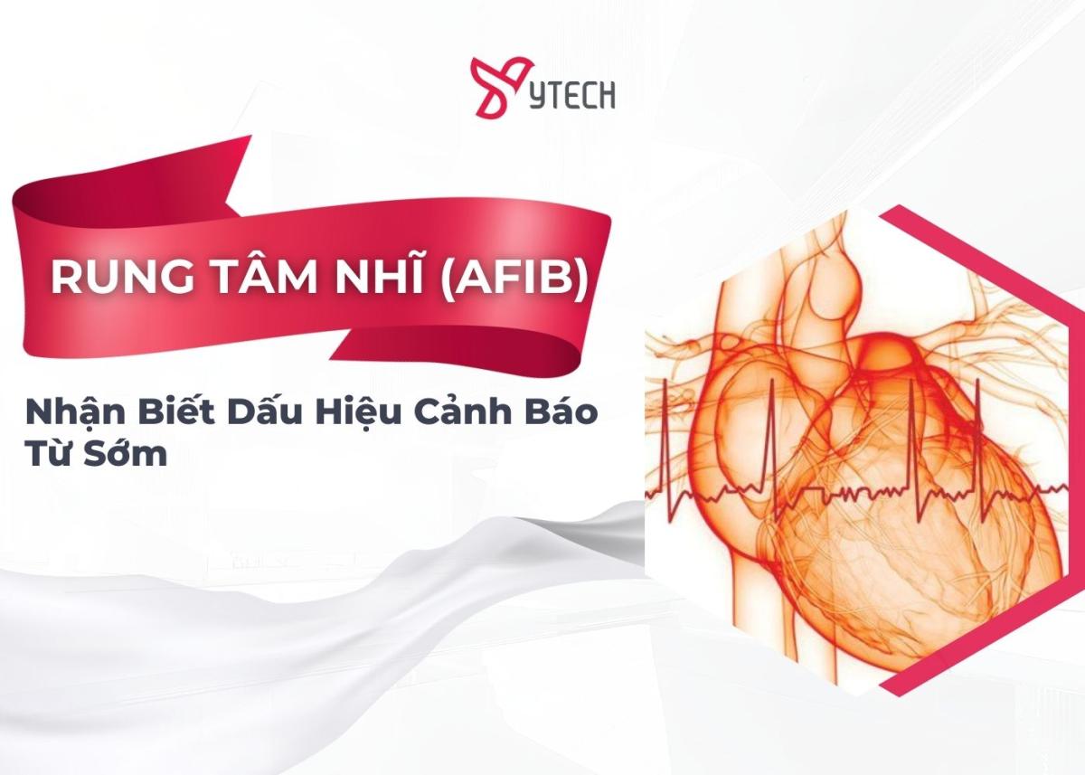 Có thể phát hiện ra các dấu hiệu cảnh báo bệnh Rung Tâm Nhĩ (Afib) được không?