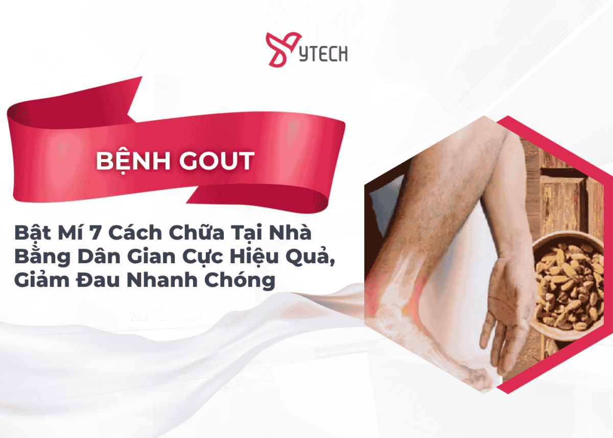 BẬT MÍ 7 CÁCH CHỮA BỆNH GOUT TẠI NHÀ BẰNG DÂN GIAN CỰC HIỆU QUẢ, GIẢM ĐAU NHANH CHÓNG