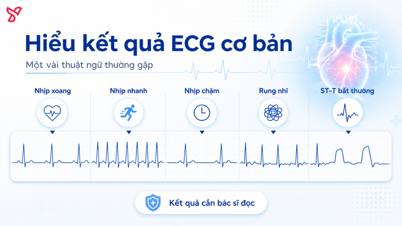 Hiểu kết quả ECG cơ bản