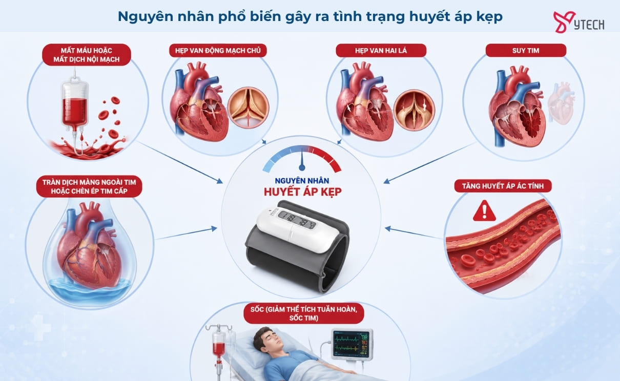 Xác định đúng nguyên nhân đóng vai trò quyết định trong xử trí huyết áp kẹp.
