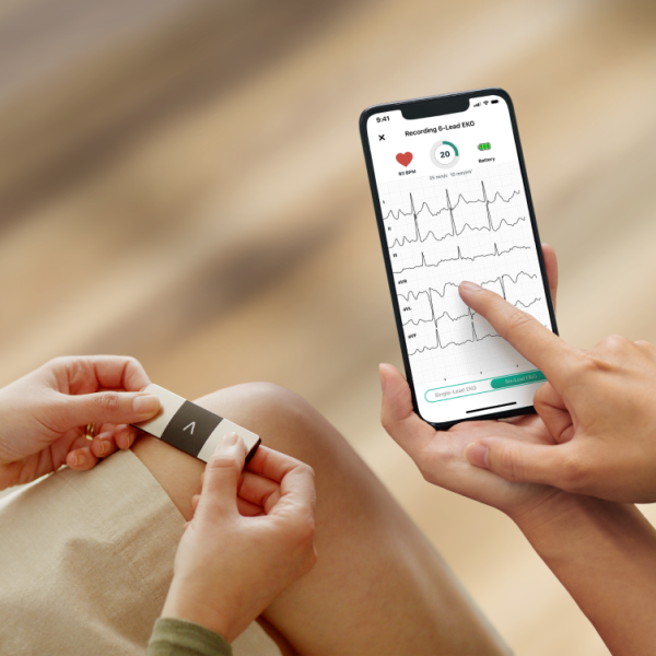 GÓI KARDIA PRO HỖ TRỢ BÁC SĨ THEO DÕI TIM MẠCH